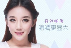 广东开外眼角价格是多少