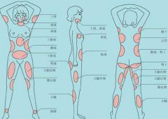 南京吸脂减肥价格是多少？