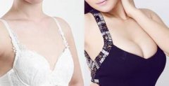 妙桃假体丰胸怎么样？妙桃假体丰胸多少钱？