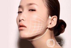 微创面部提升价格是多少?微创面部提升多少钱