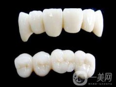 各种烤瓷牙的价格 烤瓷牙多少钱
