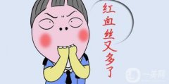 调节红血丝的费用 调节红血丝需要多少钱
