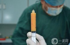 吸脂价格多少 吸脂需要多少钱