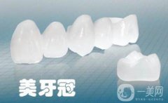 美容冠多少钱一颗 美容冠一颗的价钱是多少