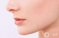 广东鼻骨矫正术大概多少钱 广东鼻骨矫正术价格分析