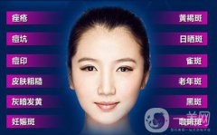 彩光嫩肤祛斑多少钱 彩光嫩肤祛斑价格介绍