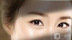 去韩国开眼角需要准备多少钱?