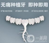 上海人工种植牙价格是多少呢?