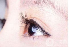 开眼角增生怎么修复 修复费用是多少