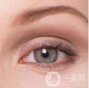埋线双眼皮价格是多少 埋线双眼皮忌口多久