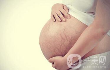 北京激光去妊娠纹价格一般是多少钱？