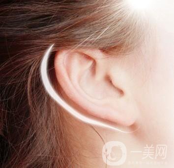 耳成形术是指什么 采用什么技术好