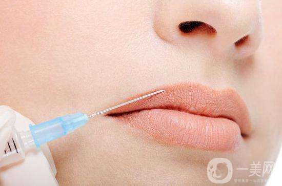 玻尿酸丰唇后遗症有哪些 多久消肿呢