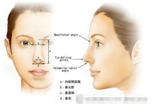 鼻小柱延长恢复过程及护理要点总结