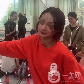 辽宁省人民医院美容科怎么样？附袁继龙隆鼻案例