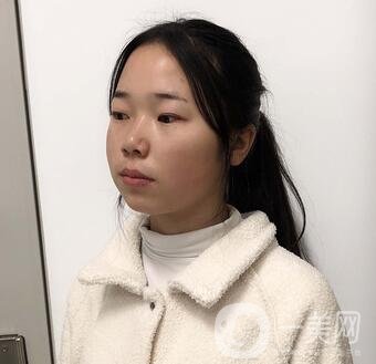 西安高一生医疗美容医院价格表，附面部吸脂案例分享