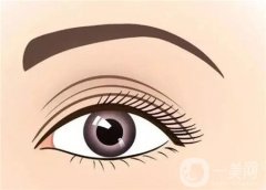 一般双眼皮手术后的后遗症有哪些？