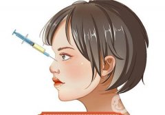 玻尿酸隆鼻的优点和缺点是什么？