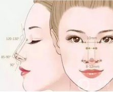 鼻翼缩小术有哪些优点及操作步骤