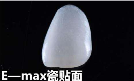 瓷贴面牙多少钱一颗？了解瓷贴面牙的价格和费用！