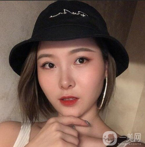 福州比华利医疗美容刘耀美自体脂肪面部填充对比图曝光