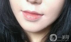 垫下巴后多久可以按摩 术后如何护理