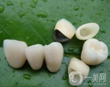 做完烤瓷牙可以使用多少年？