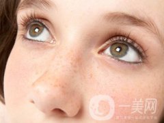 黄褐斑怎么形成的 怎么去除？