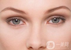 做开眼角的价格是多少钱？