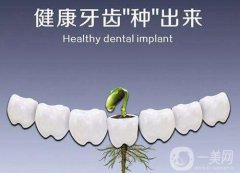种植牙后注意事项是什么 种植牙术后护理简介