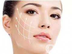 小切口面部提升手术抗衰果怎样？