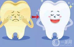 *洁牙多少钱一次?价格主要取决于那些方面?