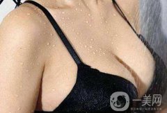 北京妙姚假体隆胸需要多少钱?