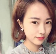 双眼皮手术拆线后要怎样护理