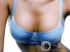 硅胶隆胸能管多久？隆胸手术具体费用