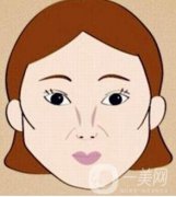 北京颧骨降低手术大概需要多少钱