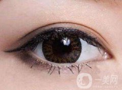 上海开眼角手术的费用是多少？