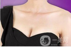 成都假体丰胸的价格