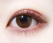 现在哪种割双眼皮好 割双眼皮价格