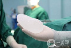 上海假体丰胸需要多少钱？