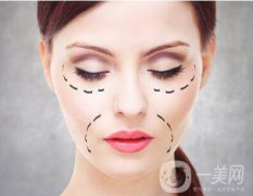 玻尿酸去除法令纹的价格和注意事项