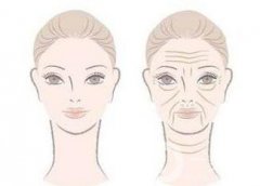 深圳*去眉间纹要多少钱?注意事项有哪些？