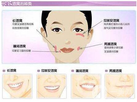 有酒窝的人都不吃藕 一笑回眸花靥媚