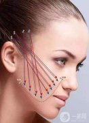 深圳做面部拉皮手术需要准备多少钱？