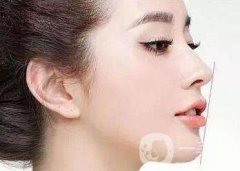 做完鼻部手术注意事项有哪些？