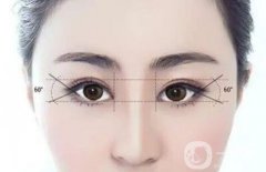 上海开眼角修复介绍？多少钱呢？