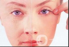 来例假可否做热玛吉呢?做热玛吉多少钱？