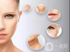 电波拉皮有哪些果呢?多少钱呢？