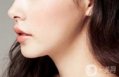 上海自体脂肪隆下巴费用是多少?注意事项有哪些？