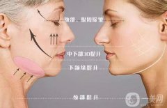 *的果到底如何呢?需要多少钱呢？